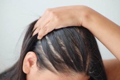 Top Benefits Of Undergoing Stem Cell Therapy For Hair At VCare
                                        
                                        
                                                