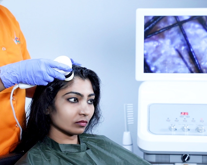 Is VCarehair loss treatment really effective  Quora