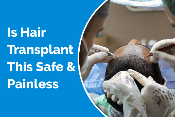 Hair Transplant - Top most Hair Transplant Treatment in India  VCare 